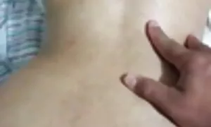 in anal prolapse ߡߎߛ ...