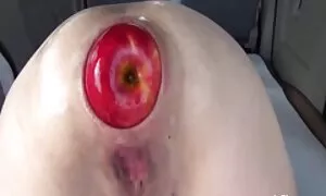 anal fisting extrême ...